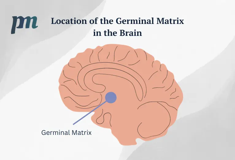 An illustration showing the location of germinal matrix in the brain, a key factor in prevention and management strategies.